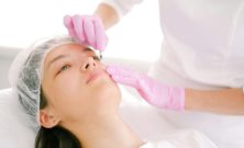 Fillers för läppar: Förståelse och möjligheter